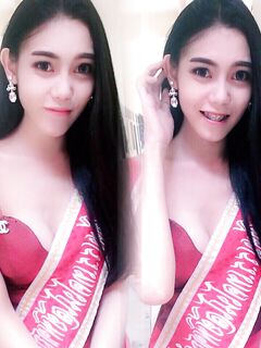 Thai pretty girl Breast augmentation