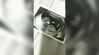 [2664 of 3935 Vids] Bree Louise (bree_louisexoxo aka breebbydance) OnlyFans Leaks Nude