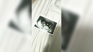 [2664 of 3935 Vids] Bree Louise (bree_louisexoxo aka breebbydance) OnlyFans Leaks Nude