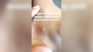 [872 of 2462 Vids] Edwinacarlaisaac (Edwina) OnlyFans Leaks Nude Ebony