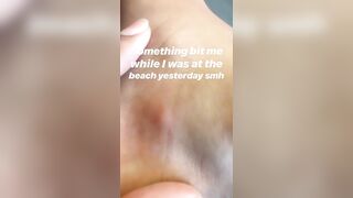 [872 of 2462 Vids] Edwinacarlaisaac (Edwina) OnlyFans Leaks Nude Ebony