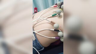 Doctor Spy Cam: Naked Chinese Girl Gyno Exam Leaked 13