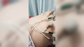Doctor Spy Cam: Naked Chinese Girl Gyno Exam Leaked 30