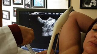 Biopsia o punción de Quiste en pecho o seno