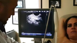 Biopsia y aspiración de Quiste en pecho o seno
