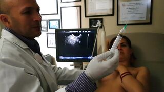 Biopsia y aspiración de Quiste en pecho o seno