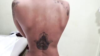 Breast Ptosis Ptosis mamaria (2)