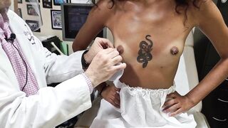Nipple areola complex another patient, microtelia. El complejo areola pezón, microtelia.